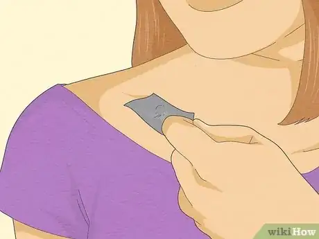 Image titled Get Rid of Skin Tags Step 5