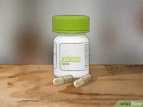 Image titled Treat Oak Mite Bites Step 8