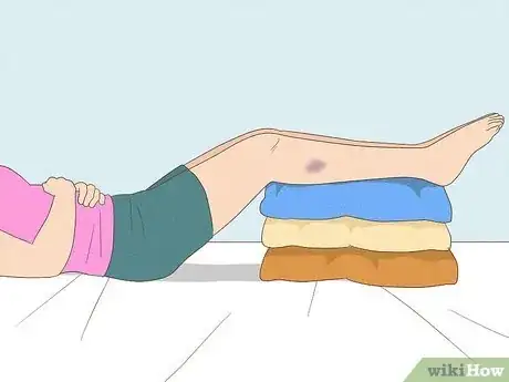 Image titled Get Rid of Bruises with Toothpaste Step 11