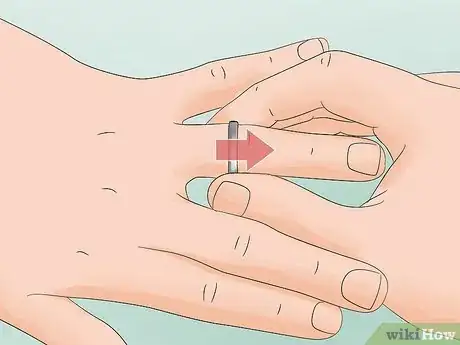 Image titled Treat a Lionfish Sting Step 2