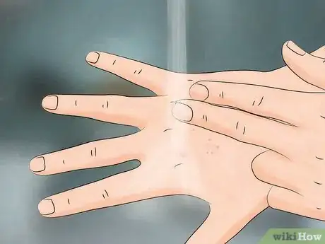 Image titled Reduce the Pain of Gnat Bites Step 1