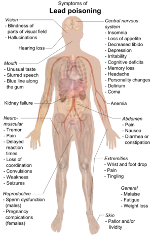 Chart of a human body with arrows pointing pieces of text to different parts of the body
